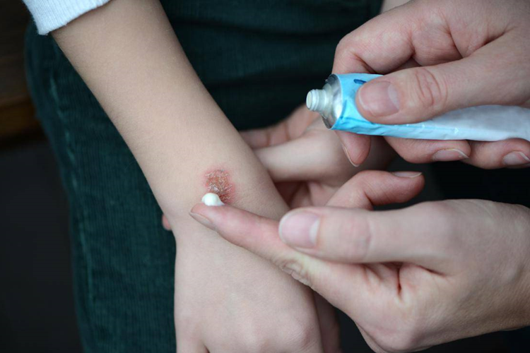 Bepanthen Plus Yanığa İyi Gelir Mi?
