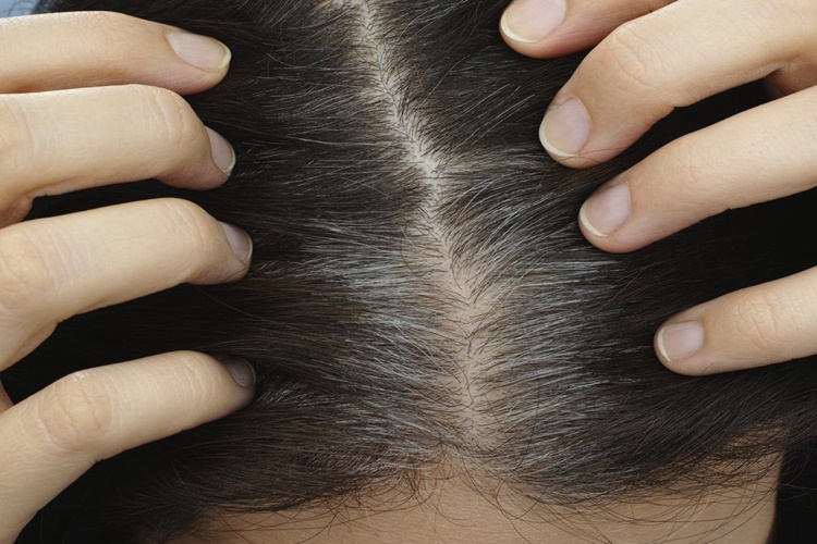 Beyaz Saç Dipleri Nasıl Kapatılır?