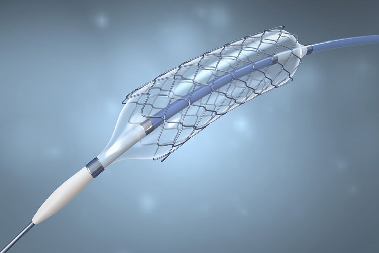 Beyne Stent Takıldıktan Sonra Dikkat Edilmesi Gerekenler Nelerdir?