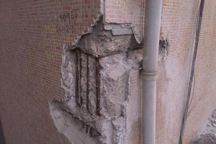 Bina Kolon Testi Nasıl Yapılır?