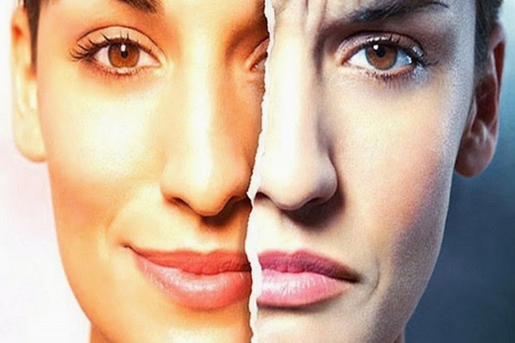Bipolar Bozukluk Ne Demektir?