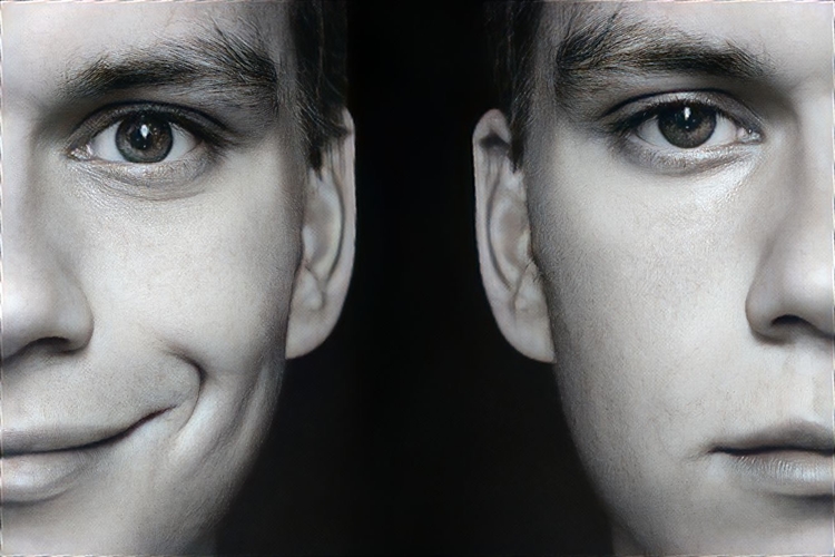 Bipolar Raporu İptal Edilir Mi?