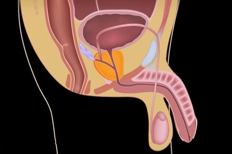 Biranın Prostata Zararları Nelerdir?