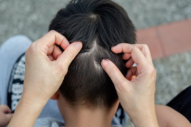 Bitler İle İlgili Bilinmesi Gerekenler Nelerdir?