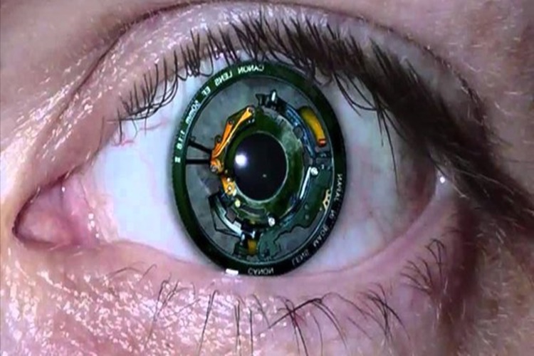 Biyonik Göz (Retina İmplantı)