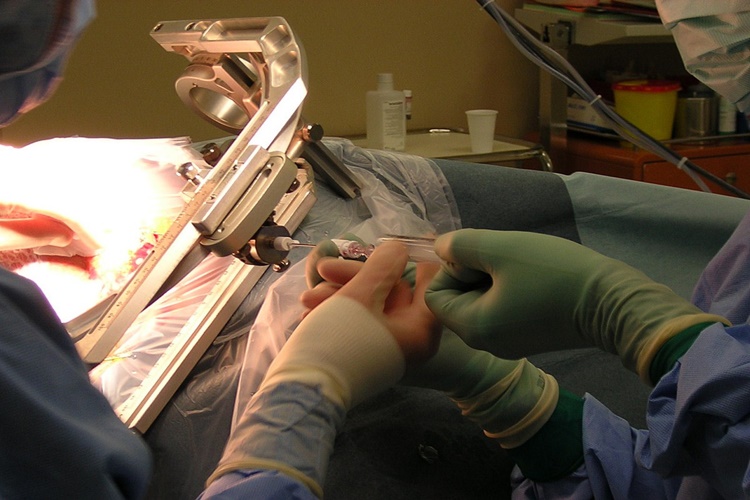 Biyopsi Hakkında Merak Edilenler Nelerdir?