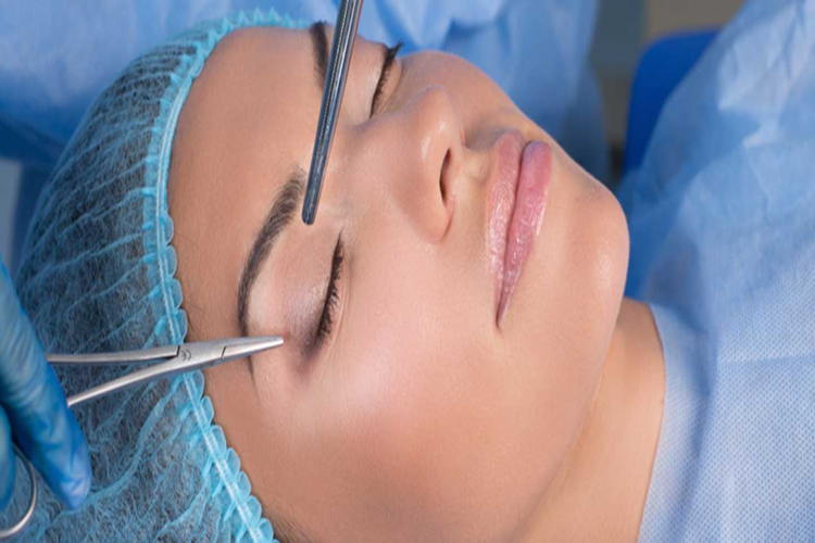 Blefaroplasti Ameliyatını Hangi Doktor Yapar? Güncel Oku