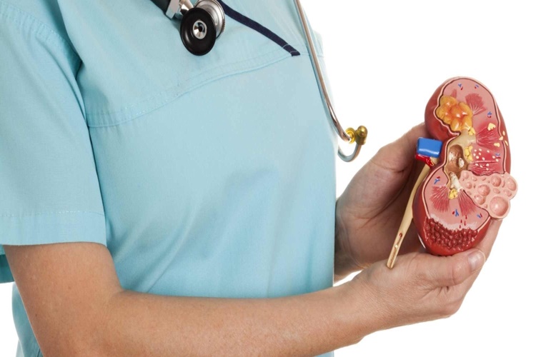 Böbrek Yetmezliği Hakkında Merak Edilenler Nelerdir?