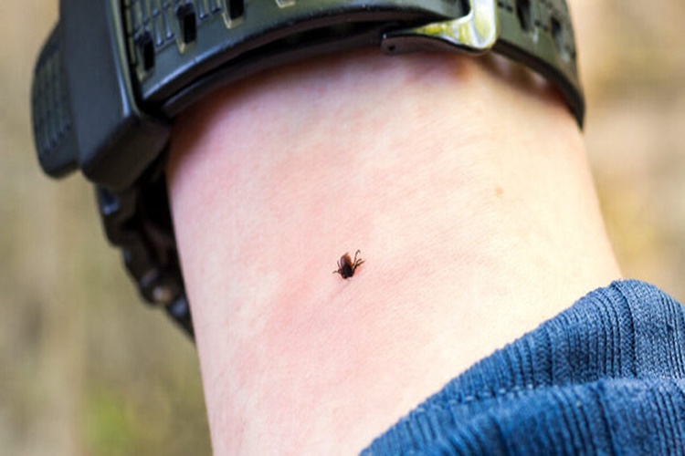 Böcek Sokması Durumunda Yapılması Gerekenler Nelerdir?