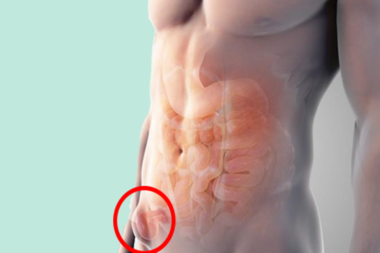 Boğulmuş Fıtık Tedavisi Nedir?