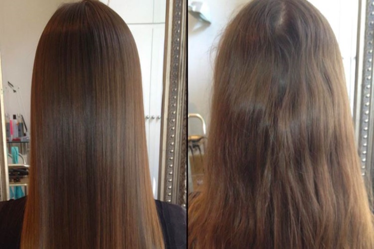 Brezilya Fönü Nedir?