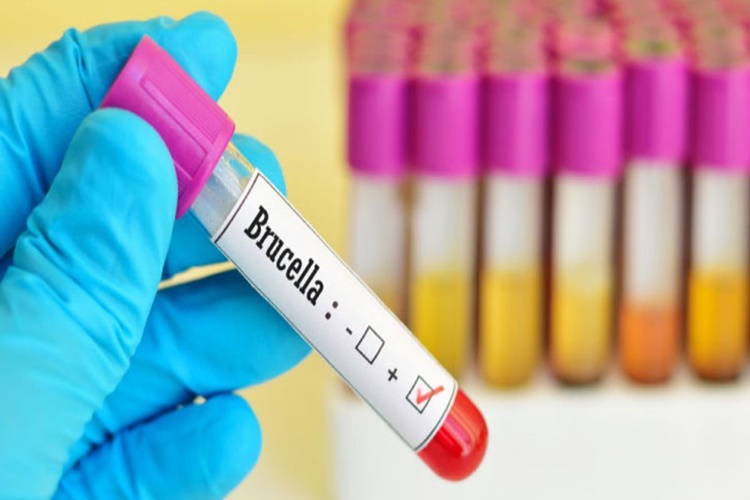 Brusella Hastalığının Tedavisi Nedir?