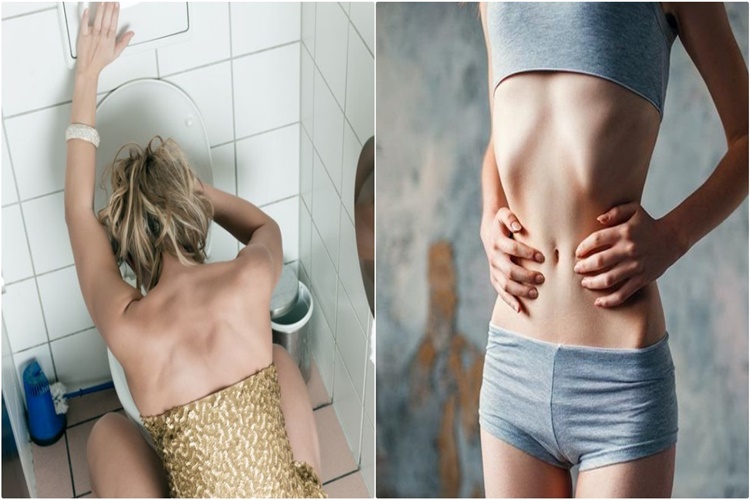 Bulimia Nervoza Tedavisi Nedir?