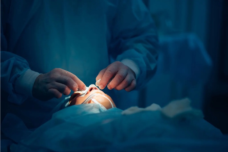 Burun Ameliyatı Sonrası Dikişler Ne Zaman Erir?