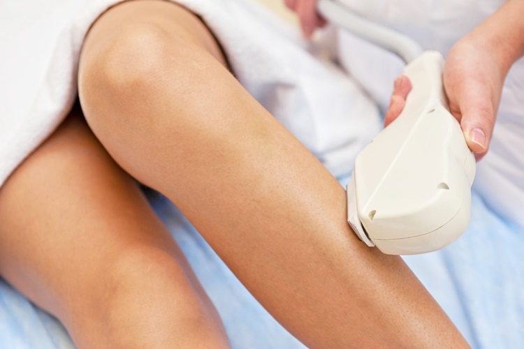 Buz Lazer Acıtıyor Mu?