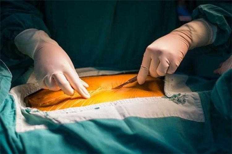 Bypass Sonrası Çoklu Organ Yetmezliği Nedir?