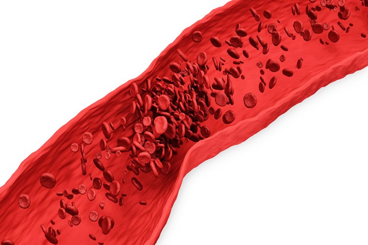 C Vitamini Eksikliği Kanı Pıhtılaştırır Mı?