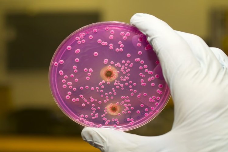 Candida Gaita Testi Nedir?