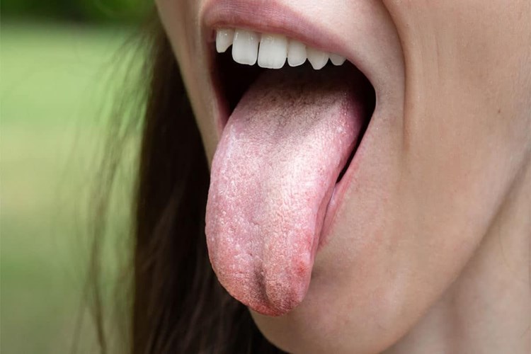 Candida İçin C Vitamini İyi Gelir Mi?
