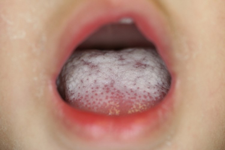 Candida İle Uyumlu Fungal Organizma Nedir?