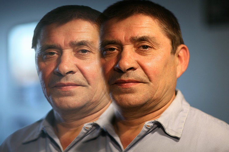 Çift Görmenin Tedavisi Var Mı?