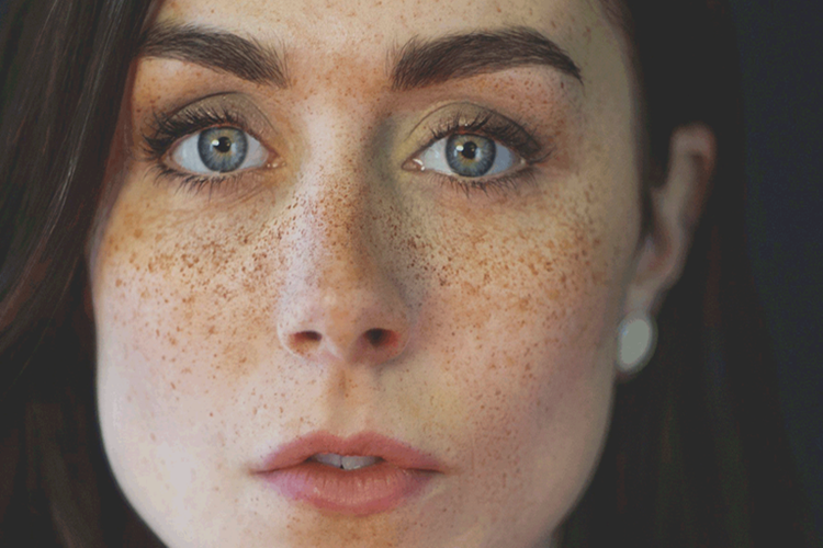 Çil Tedavisi Nasıl Yapılır?