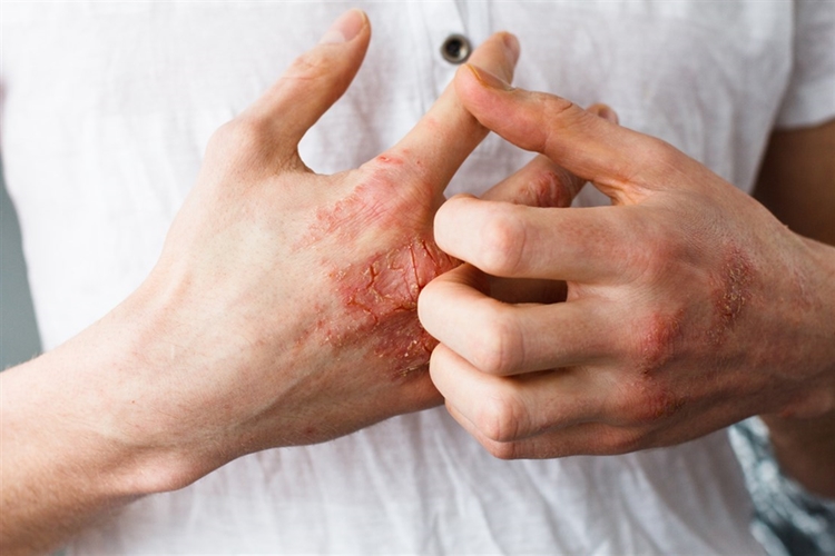 Cildiye Ve Dermatoloji Aynı Mı?