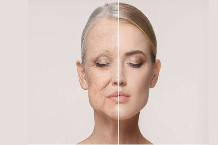 Cilt Kırışıklıkları Hakkında Merak Edilen Bilgiler