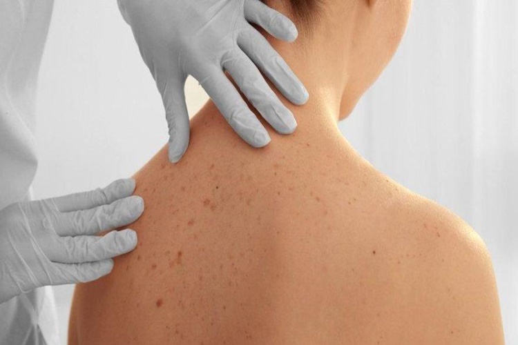 Cilt Sorunları Hakkında Merak Edilen Bilgiler