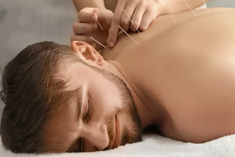 Çin İğnesi Nasıl İşlenir?