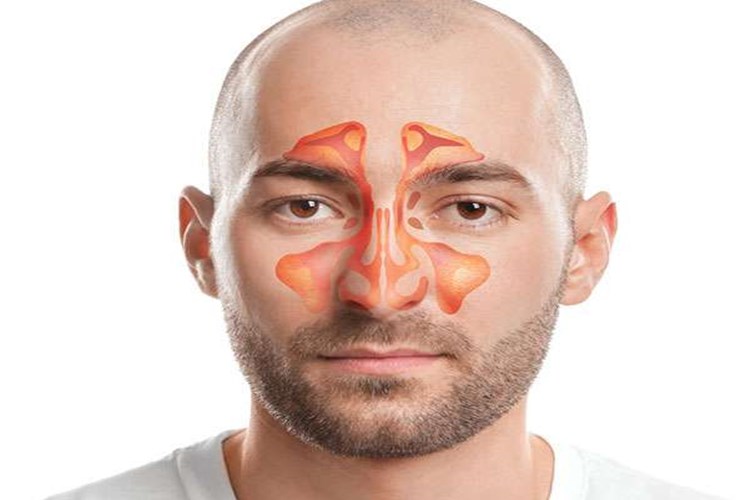 Çocuklarda Sinüzit Ateş Yapar Mı?