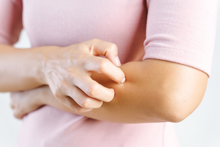 Collagen Kaşıntı Yapar Mı?