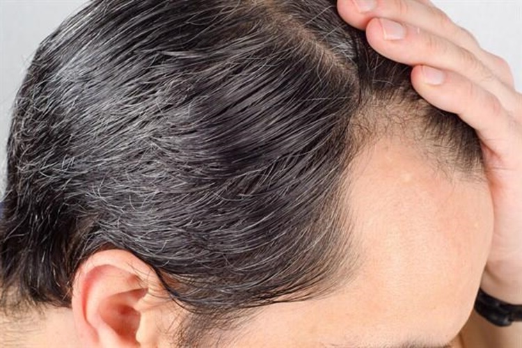 Collagen Saç Çıkarır Mı?