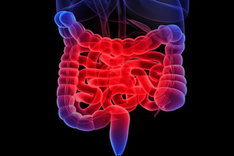 Çölyak Kabızlık Yapar Mı?