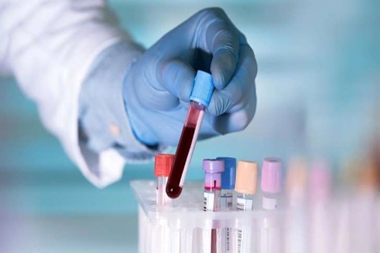 Coombs Testi Nasıl Yapılır?