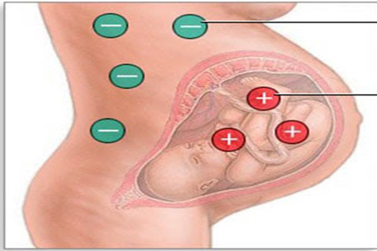  Coombs Testi Neyi Gösterir?