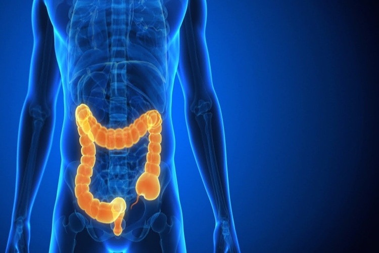 Crohn Hastaları Engelli Raporu Alabilir Mi?