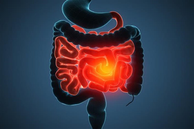Crohn Hastalığı Beslenme Nasıl Olmalıdır?