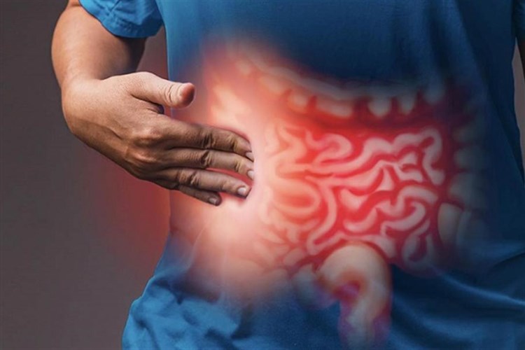 Crohn Hastalığı Hangi Yaşlarda Görülür?
