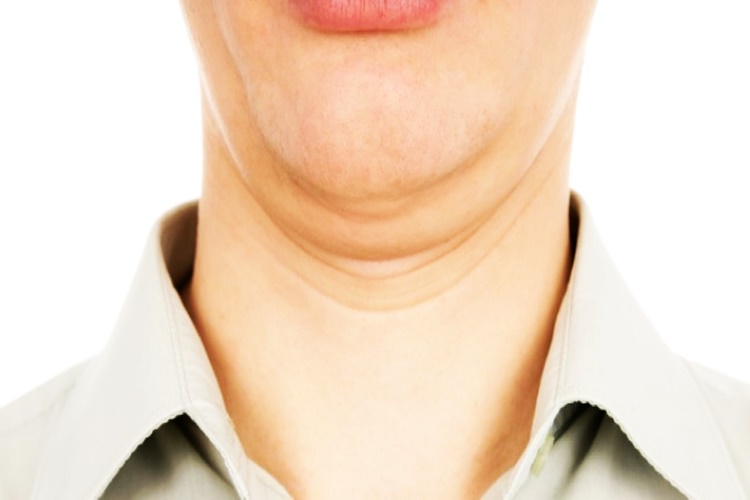 Cushing Hastalığı Kanser Midir?