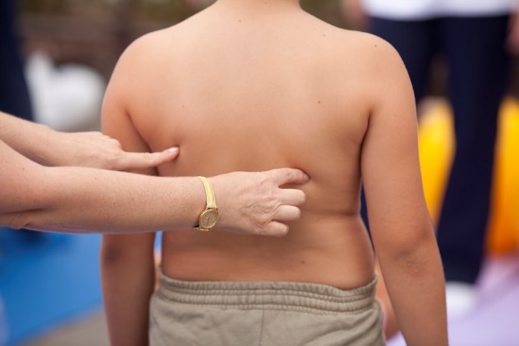 Cushing Hastalığı Tedavi Edilmezse Ne Olur?