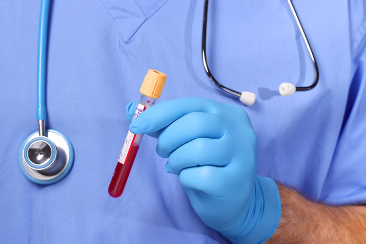 D Vitamini Ölçümü Aç Karnına Mı Yapılır?