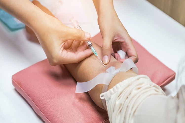 D Vitamini Testi Aç Karnına Mı Yapılır?