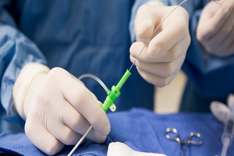 Damara Stent Takıldıktan Sonra Pıhtı Atması Nasıl Geçer?