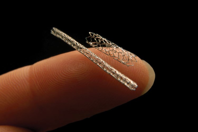 Damara Stent Takıldıktan Sonra Pıhtı Atması Neden Olur?