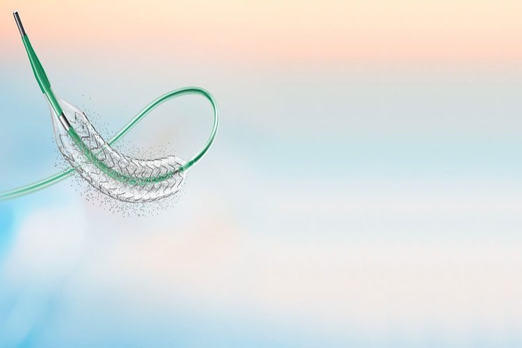 Damara Stent Takıldıktan Sonra Yan Etkileri Nasıl Geçer?