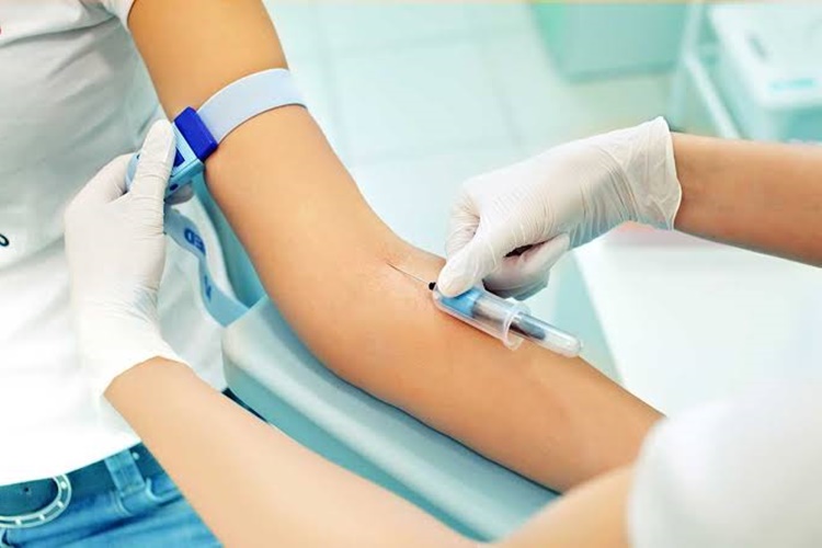 Damarda Anevrizma Nedir?