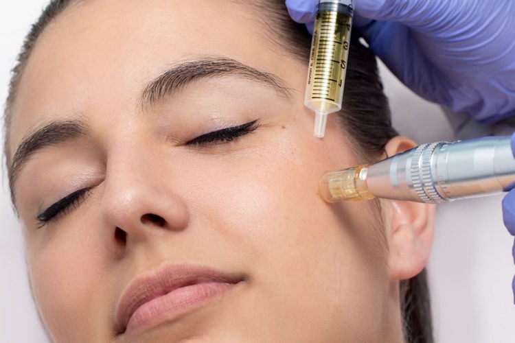 Dermapen Nasıl Uygulanır?