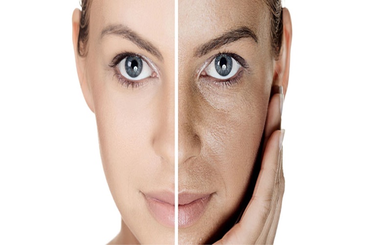 Dermapen Sonrası Karbon Peeling Yapılır Mı?