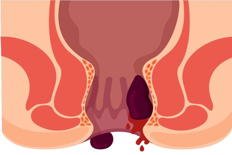 Dermatop Krem Basura İyi Gelir Mi?